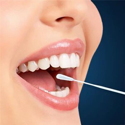 Buccal flocked tamponi
